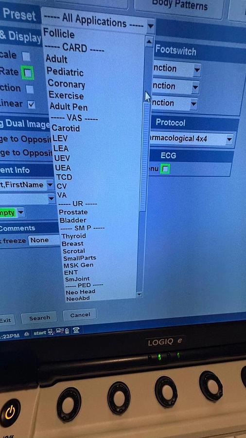 Refurbished Refurbished GE Logiq E ultrasound with  convex L4-12t Or L10-22 Transducer