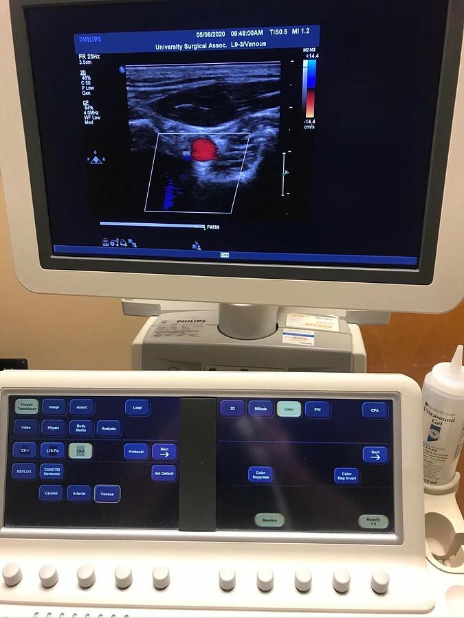 Refurbished PHILIPS Ultrasound  IE33 "R" CART