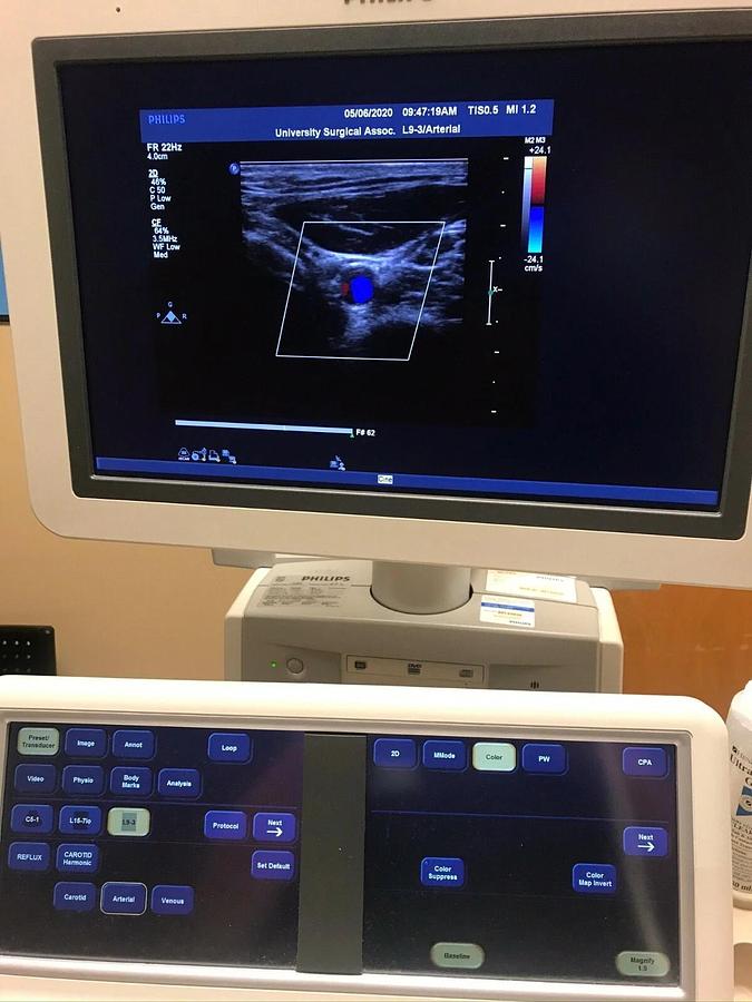Refurbished PHILIPS Ultrasound  IE33 "R" CART