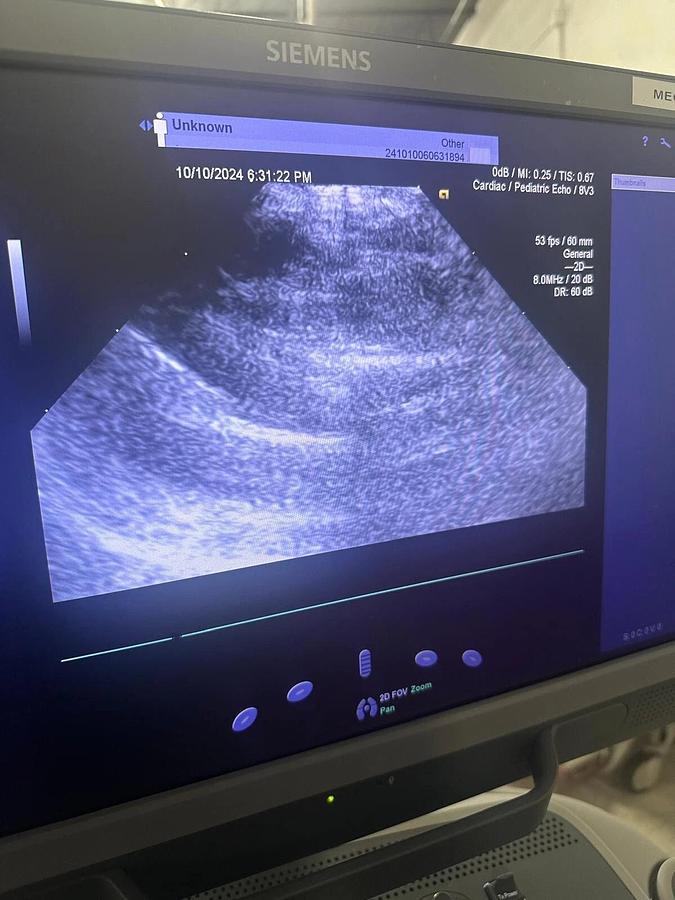 Refurbished 2019 Siemens Acuson S2000 with 8V3 , 4V1c, 10V4  Probes