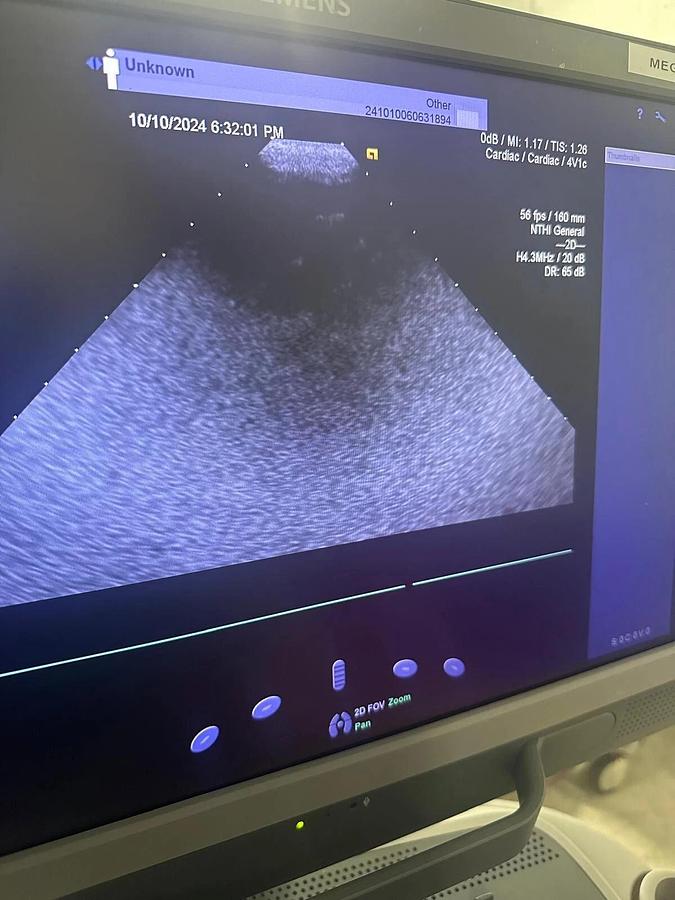 Refurbished 2019 Siemens Acuson S2000 with 8V3 , 4V1c, 10V4  Probes