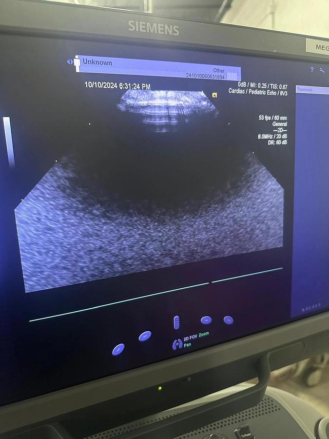 Refurbished 2019 Siemens Acuson S2000 with 8V3 , 4V1c, 10V4  Probes