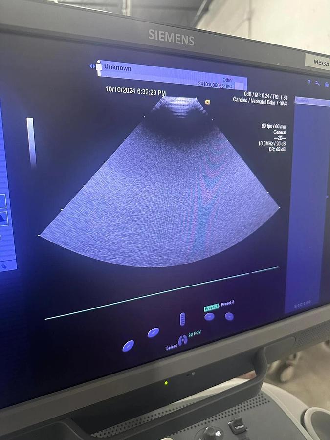 Refurbished 2019 Siemens Acuson S2000 with 8V3 , 4V1c, 10V4  Probes