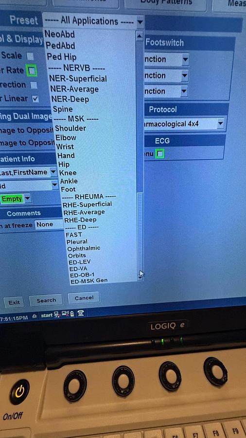 Refurbished Refurbished GE Logiq E ultrasound with  convex L4-12t Or L10-22 Transducer