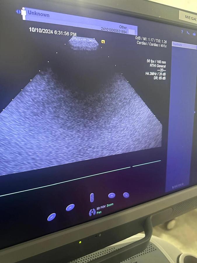 Refurbished 2019 Siemens Acuson S2000 with 8V3 , 4V1c, 10V4  Probes