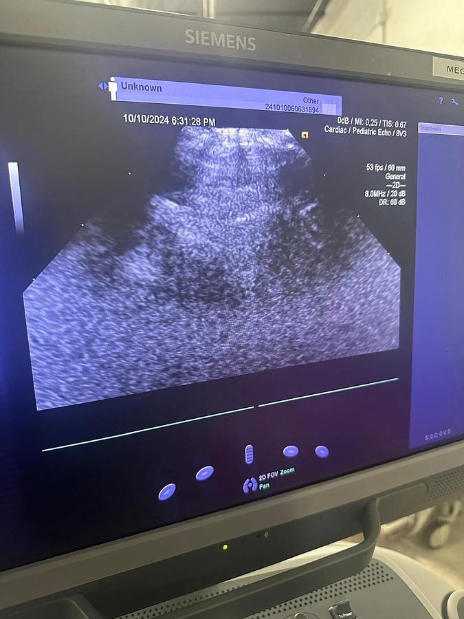 Refurbished 2019 Siemens Acuson S2000 with 8V3 , 4V1c, 10V4  Probes