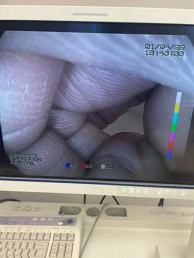 Used Pentax EC-3490LK Colonoscope Endoscope Endoscopy(1315-S13)_