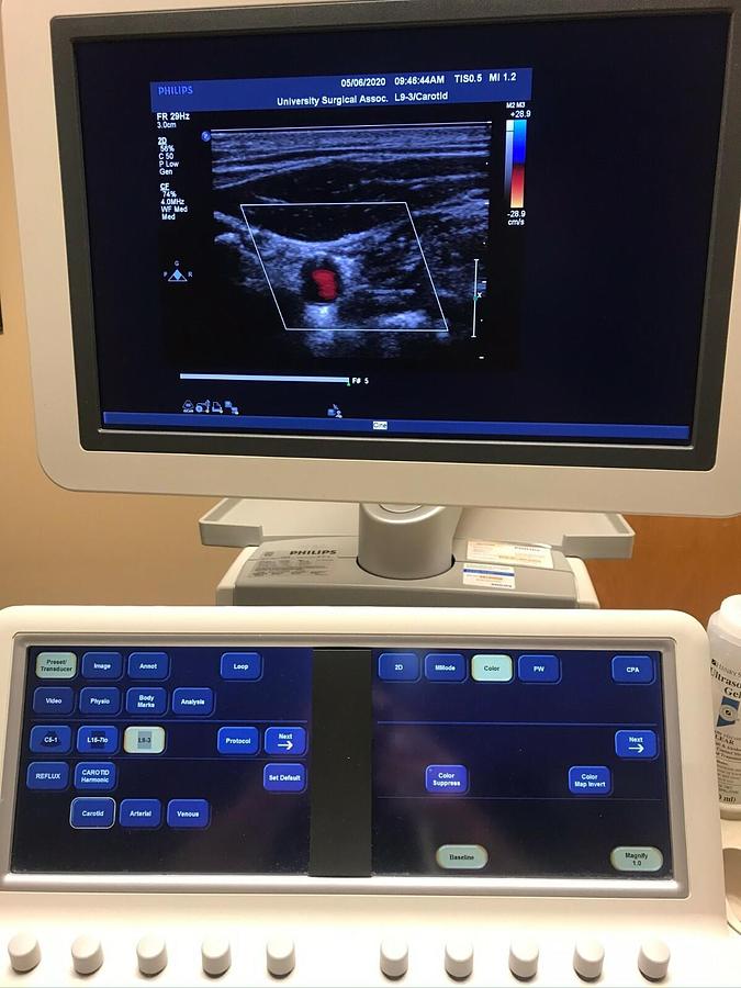 Refurbished PHILIPS Ultrasound  IE33 "R" CART