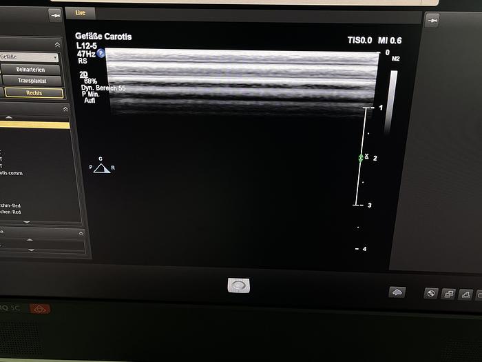 Gebraucht Philips EPIQ 5C Ultraschallsystem mit Sony Drucker