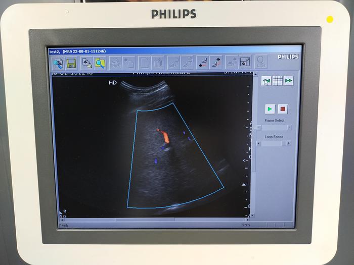 Gebraucht Philips HD7 XE Diagnostik Ultraschallsystem mit konvex Sonde, Drucker und DVD Brenner