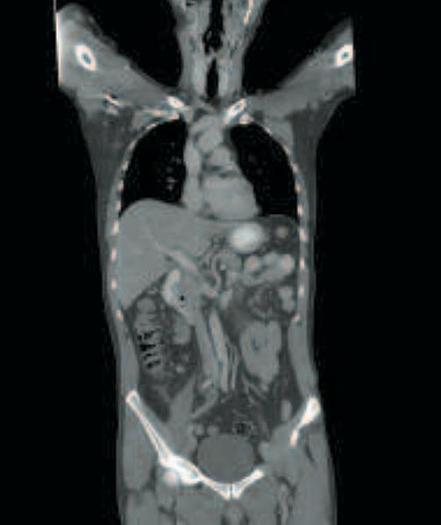Reformado GE LightSpeed VCT