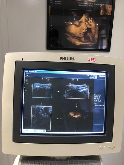 Gebraucht Philips HD11 Ultraschallgerät mit 3x Sonden, Sony Drucker UP-D895MD