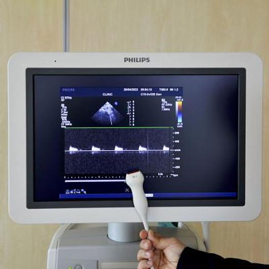 D'occasion ECHOCARDIOGRAPHE PHILIPS IU22 RADIO + CARDIO + GYNECO