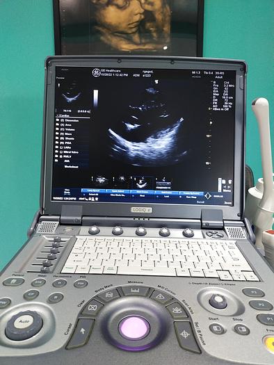 Gebraucht GE LOGIQ e tragbare Ultraschallgerät inkl. 2 Sonden und Mitsubishi P93 Drucker