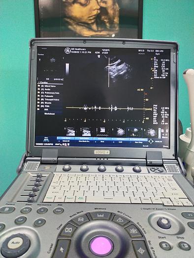 Gebraucht GE LOGIQ e tragbare Ultraschallgerät inkl. 2 Sonden und Mitsubishi P93 Drucker