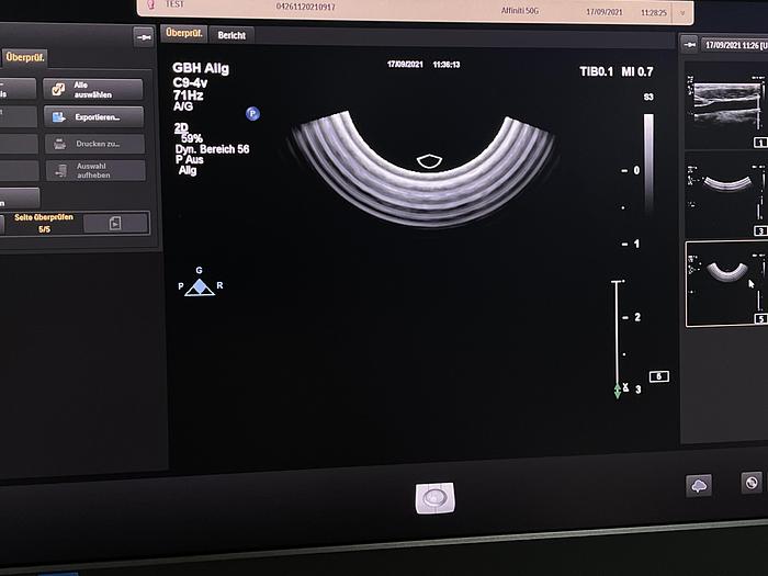 Gebraucht Philips Affiniti 50G Ultraschallgerät mit Sony Drucker