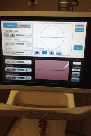 Used Syneron Co2re Core Co2 Laser Fractional C02 Laser