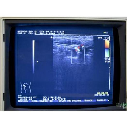 Used ECHOGRAPHE HITACHI EUB 525 COULEUR DOPPLER AVEC 2 SONDES