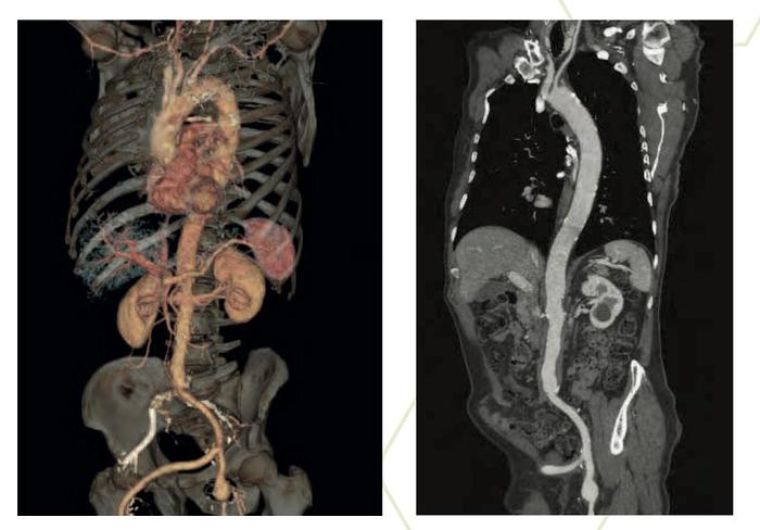 Used 2018 General Electric (GE) Optima CT660