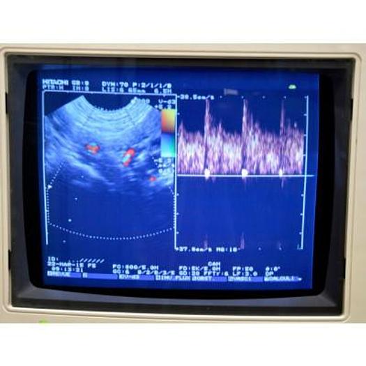 D'occasion ECHOGRAPHE HITACHI KATANA 5 COULEUR DOPPLER AVEC 3 SONDES