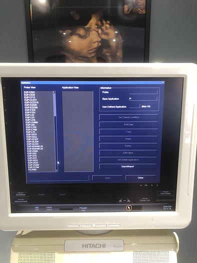 Gebraucht Hitachi-Avius-Ultraschallgerät-2007