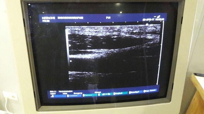 Used Hitachi EUP-053T Intraoperative Ultraschallsonde