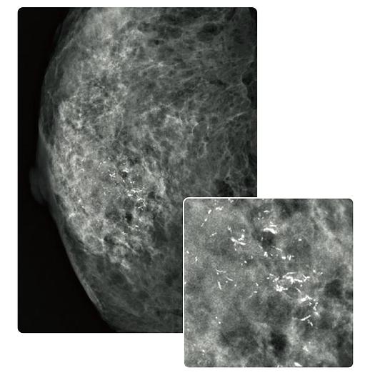 2021 FujiFilm FDR Amulet Innovality