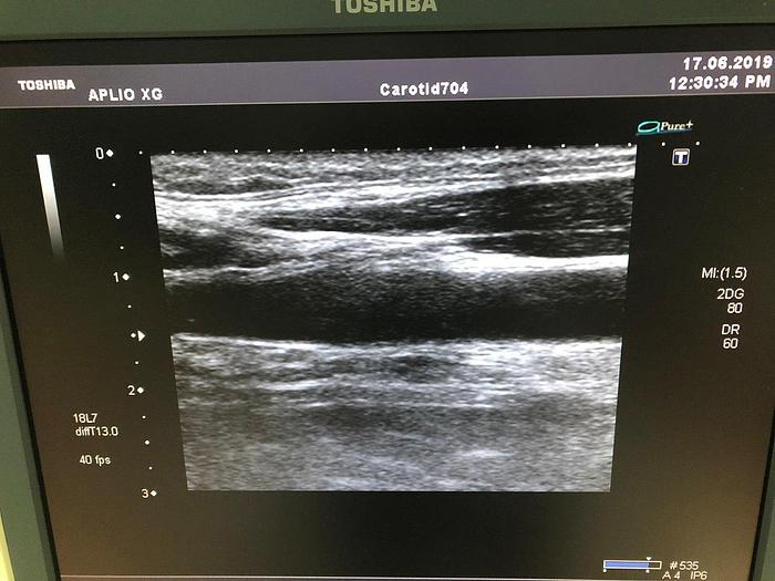 Gebraucht Toshiba PLT-1204BT Lineare Sonde