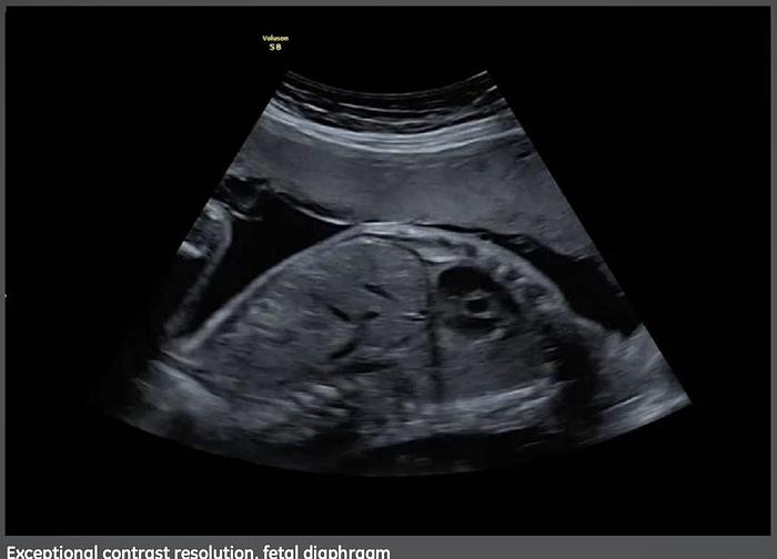 Used 2014 General Electric (GE) Voluson S8