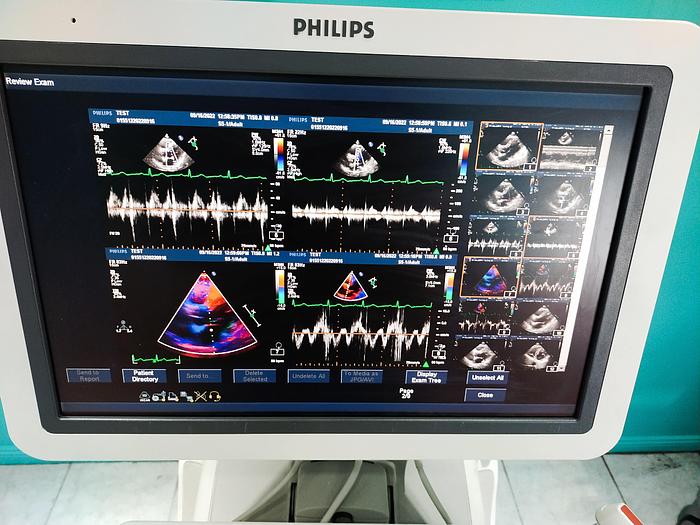 Gebraucht Philips IE33