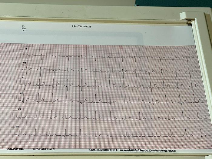 Gebraucht Mortara Instrument ELI 250 EKG Gerät auf Trolley mit EKG Kabel