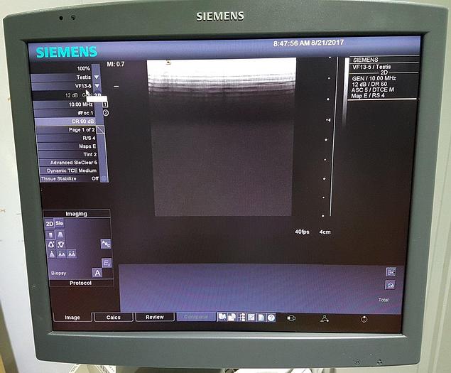 Gebraucht Siemens Acuson Antares Premium Edition 10032746 Ultraschallgerät Flachbildmonitor 5 Sonden Drucker