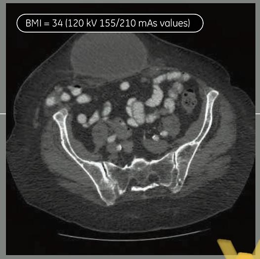 Used 2018 General Electric (GE) Optima CT660