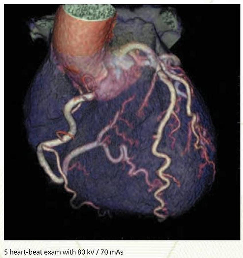 Reformado Tomografo Optima 660 GE (General Electric) 64 cortes