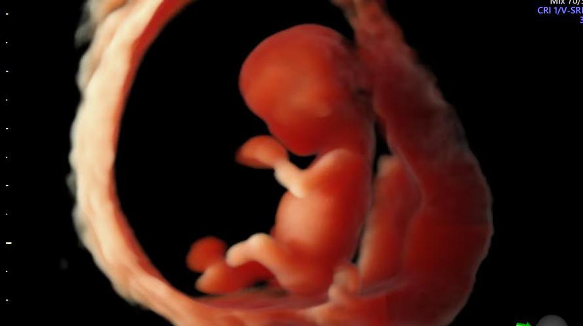 Refurbished 2026 General Electric (GE) Voluson E8