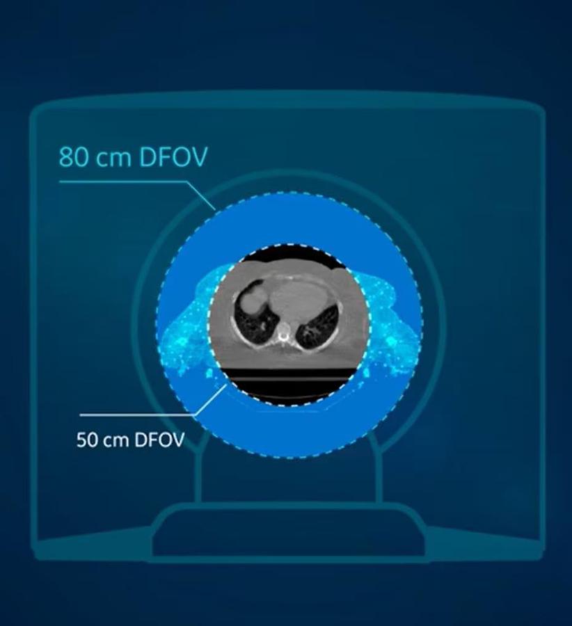 Refurbished Tomografo General Electric (GE) Discovery CT590 RT