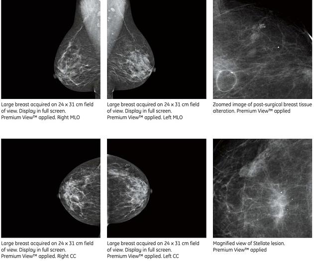 Used Mastógrafo Digital GE Essential