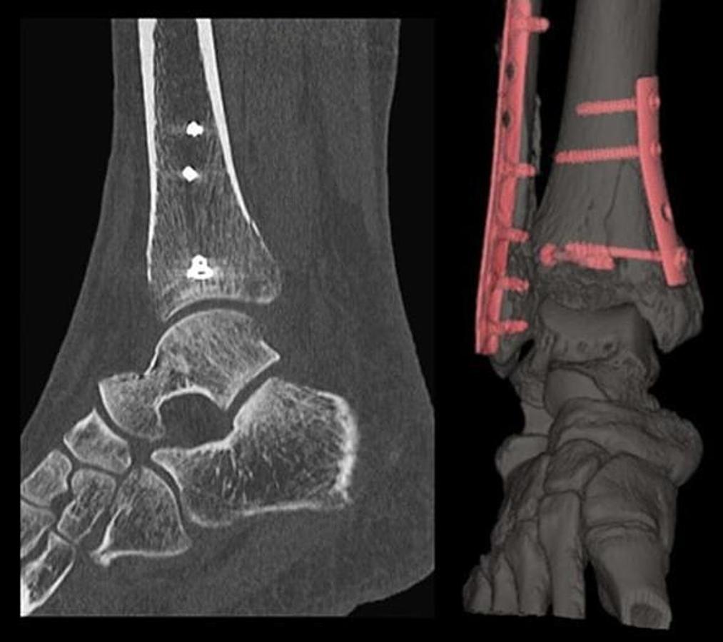 Usado 2017 General Electric (GE) Revolution EVO