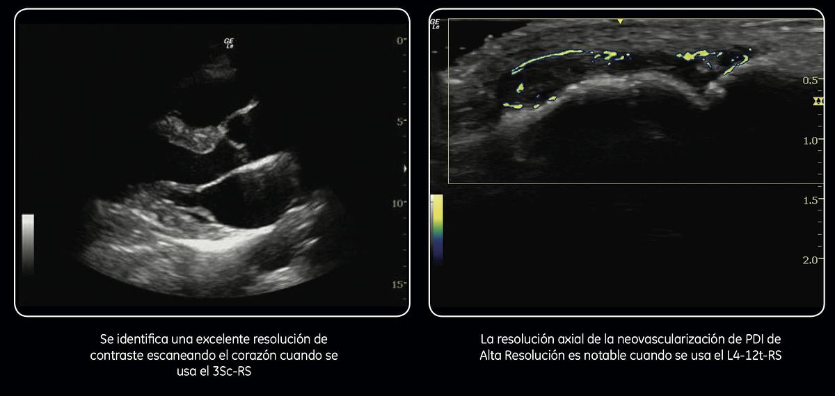 Refurbished Ultrasonido portátil General Electric (GE) LOGIQ e