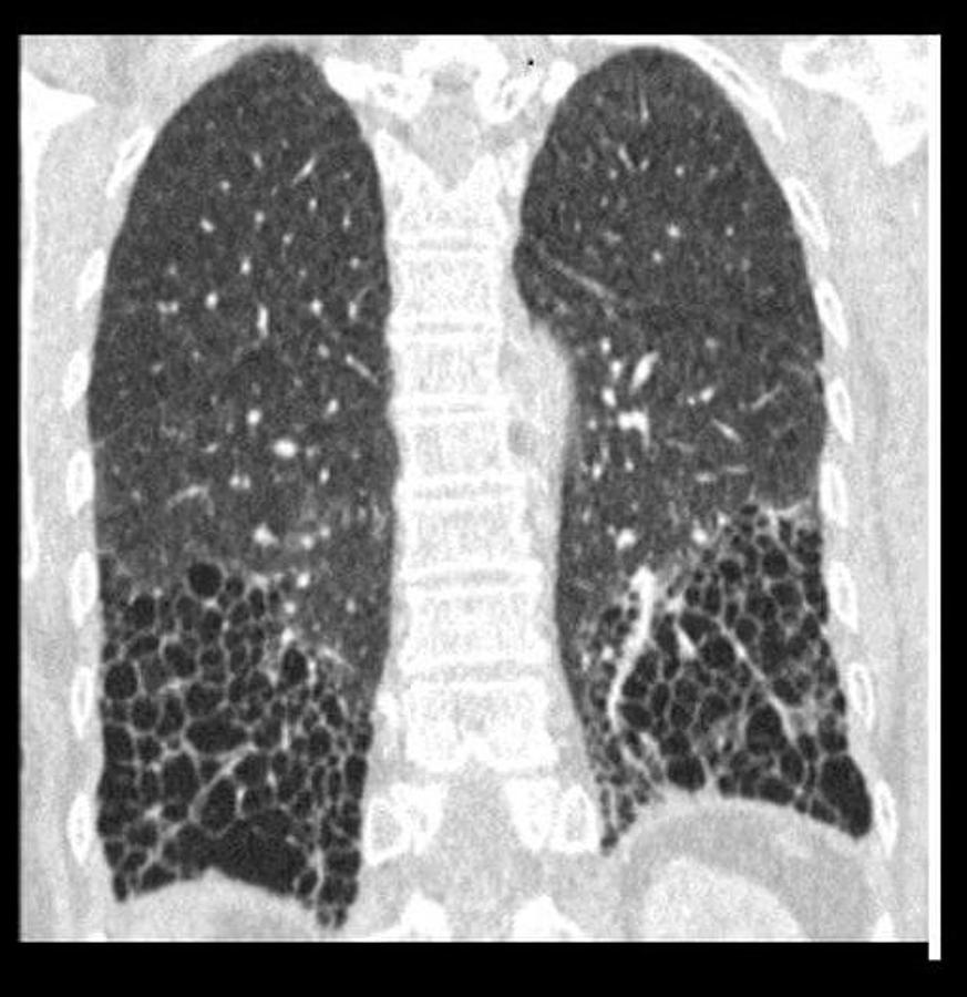 Usado 2017 General Electric (GE) Revolution EVO