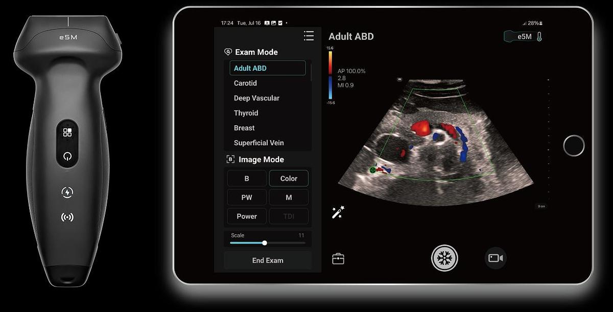 Refurbished Ultrasonido General Electric (GE) LOGIQ E10