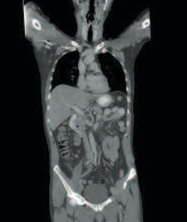 Refurbished General Electric (GE) LightSpeed VCT