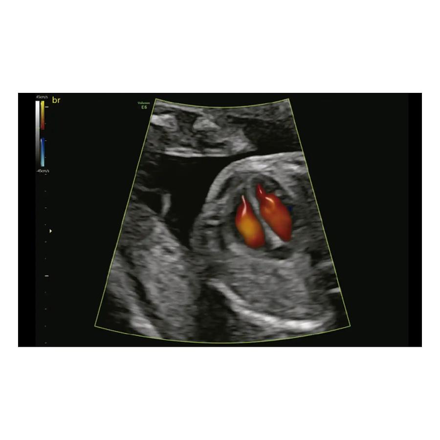 Used 2018 General Electric (GE) Voluson P8