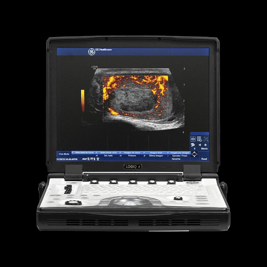 Refurbished Ultrasonido portátil General Electric (GE) LOGIQ e