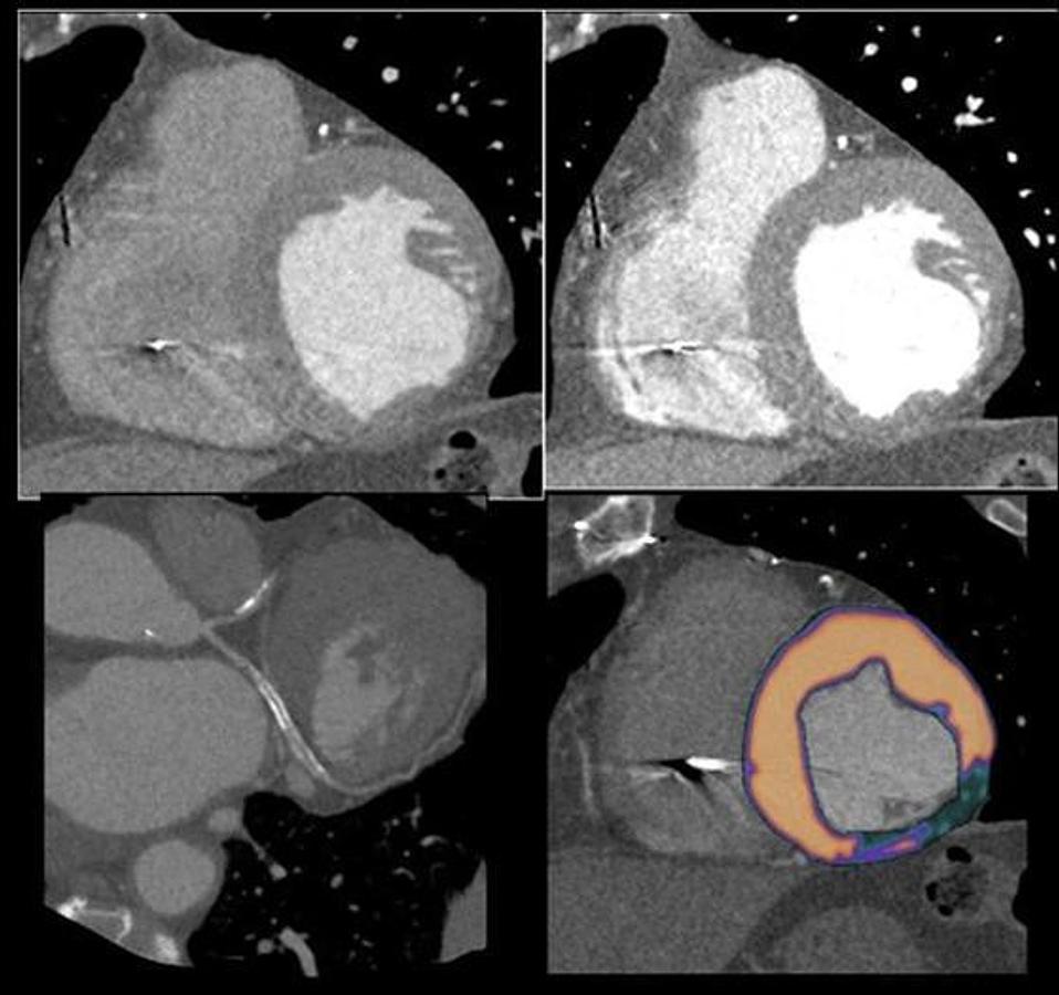 Usado 2017 General Electric (GE) Revolution EVO