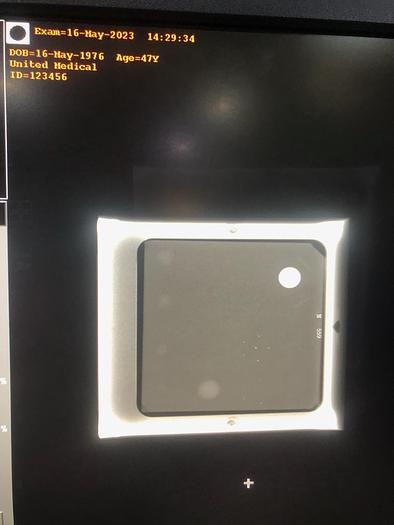 Refurbished 2024 General Electric (GE) Essential Senographe