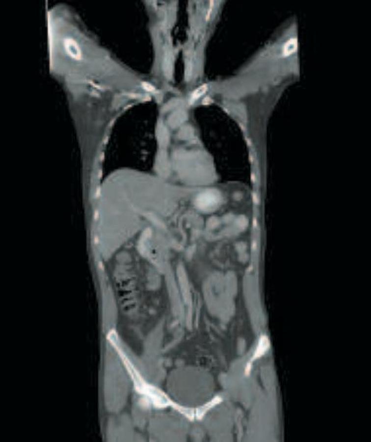 Refurbished General Electric (GE) LightSpeed VCT