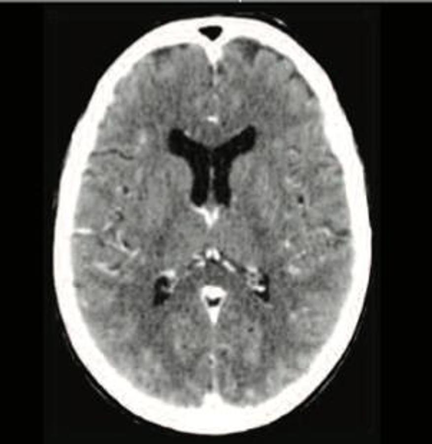 Refurbished Tomógrafo GE (General Electric) BrightSpeed Elite de 16 cortes