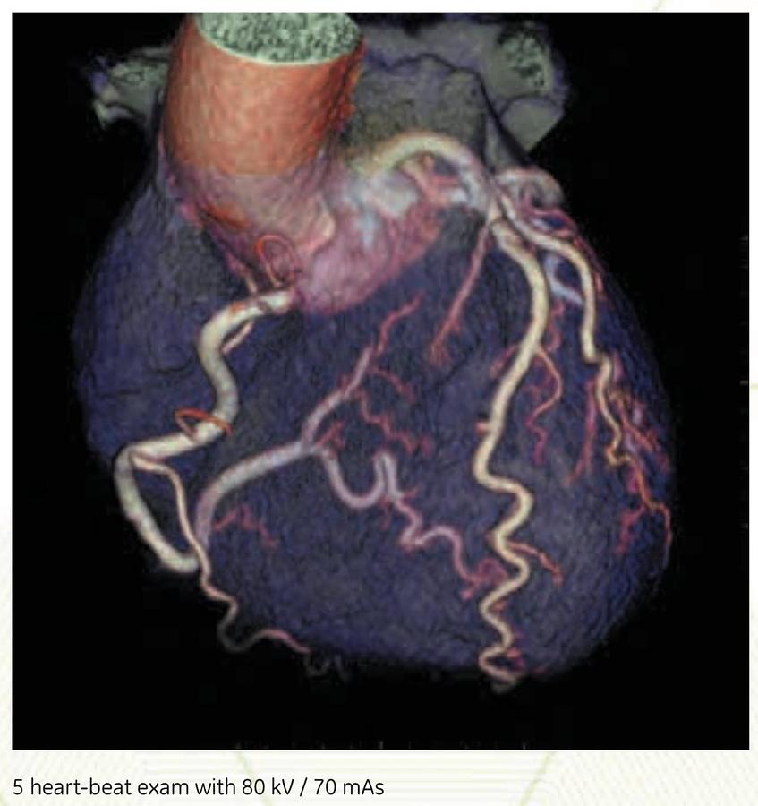 Reformado Tomografo General Electric Optima 660 de 64 cortes