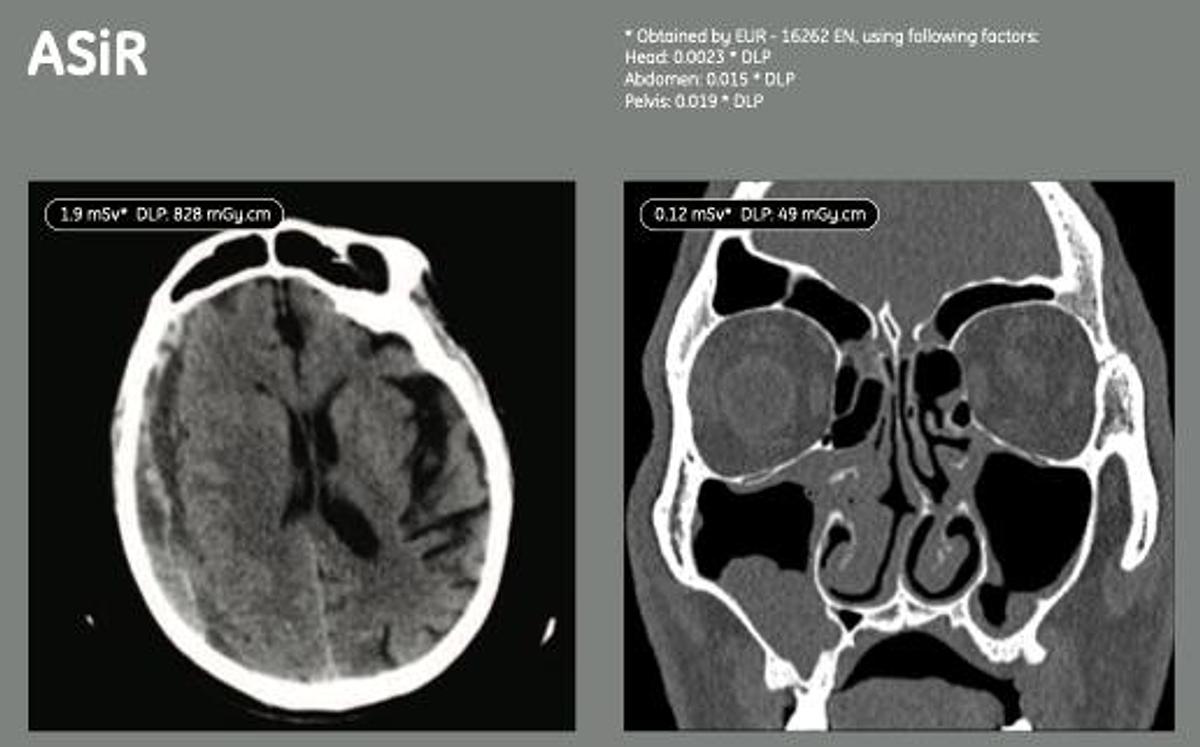 Refurbished Tomógrafo GE (General Electric) BrightSpeed Elite de 16 cortes